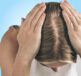Dry scalp being treated as part of a scalp relief care routine