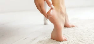 Prepare Summer-Ready Feet: Fix Cracked Heels - a person applying Flexitol Heel Balm to their cracked heel. heel balm dry cracked feet heels flexitol
