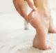 Prepare Summer-Ready Feet: Fix Cracked Heels - a person applying Flexitol Heel Balm to their cracked heel. heel balm dry cracked feet heels flexitol