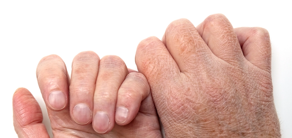 Healing Hands: How Hand Balm Can Soothe and Repair Damaged Skin