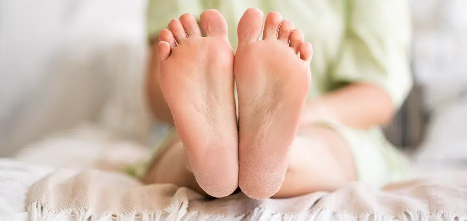 what causes skin on your feet and heels to crack and split