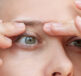 Eyelid Eczema: Causes and Symptoms